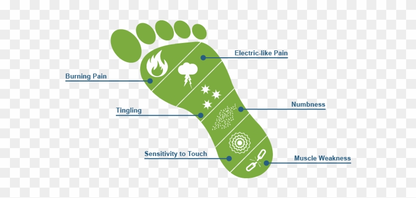 Peripheral Neuropathy And Acupuncture - Peripheral Neuropathy #930498