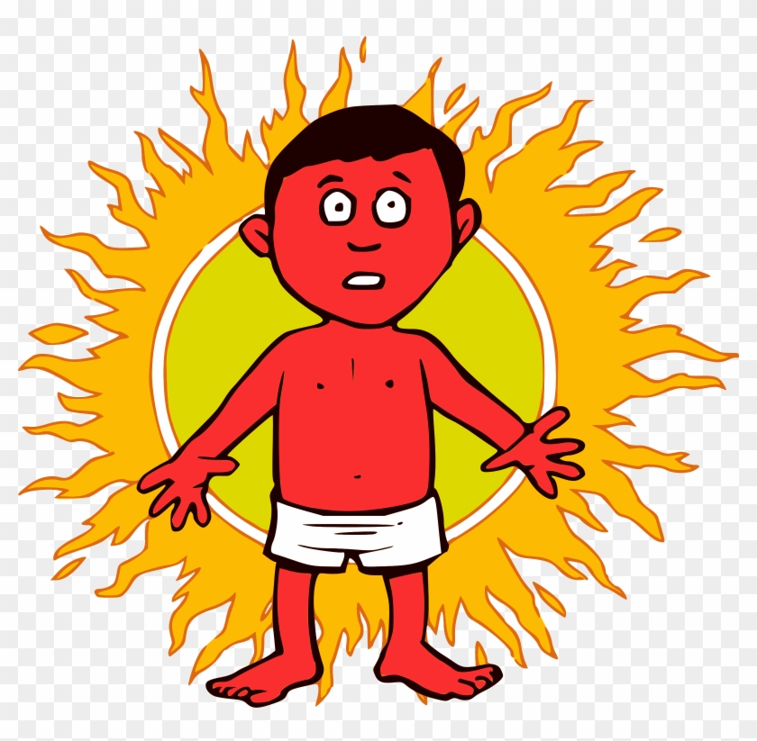 Sunburn Clipart - Sunburn Clipart #172550