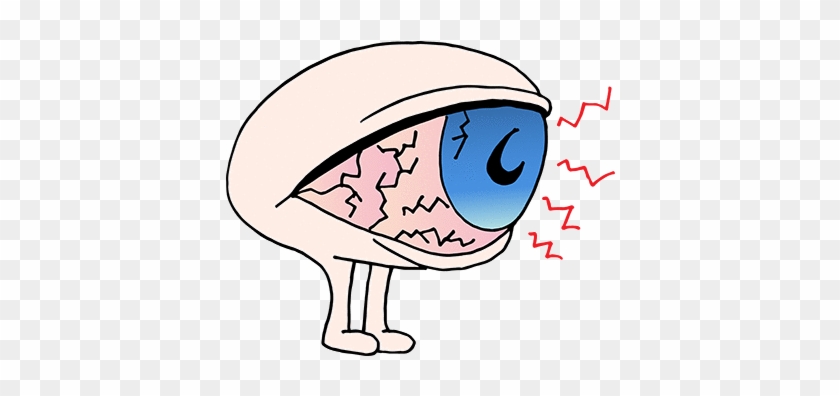 The First Type Is Due To The Eyes Not Producing Enough - Dry Syndrome Cartoon Eyes #971742