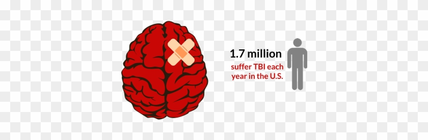 Common Causes Of Brain Injuries - Traumatic Brain Injury Png #993754