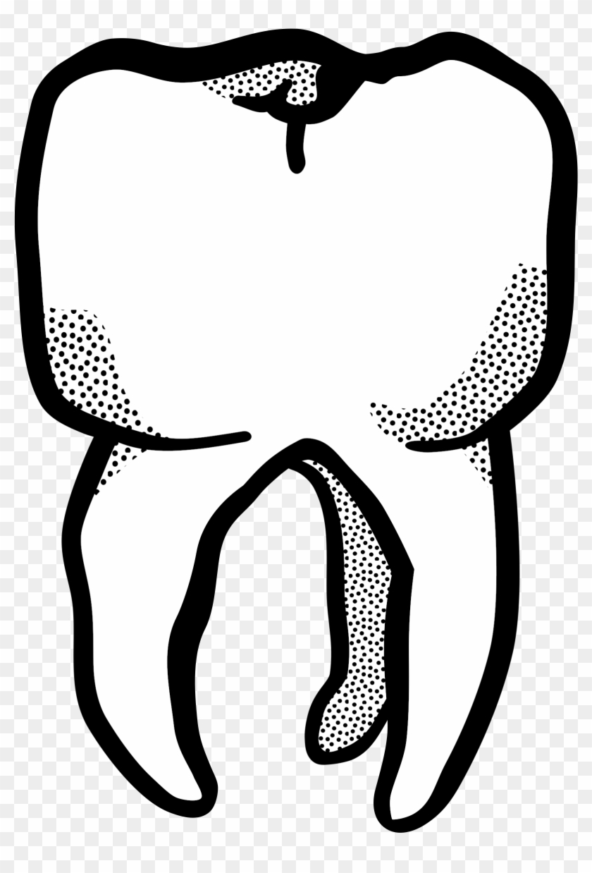 Clip Art Tooth - Zahn Clipart #175880