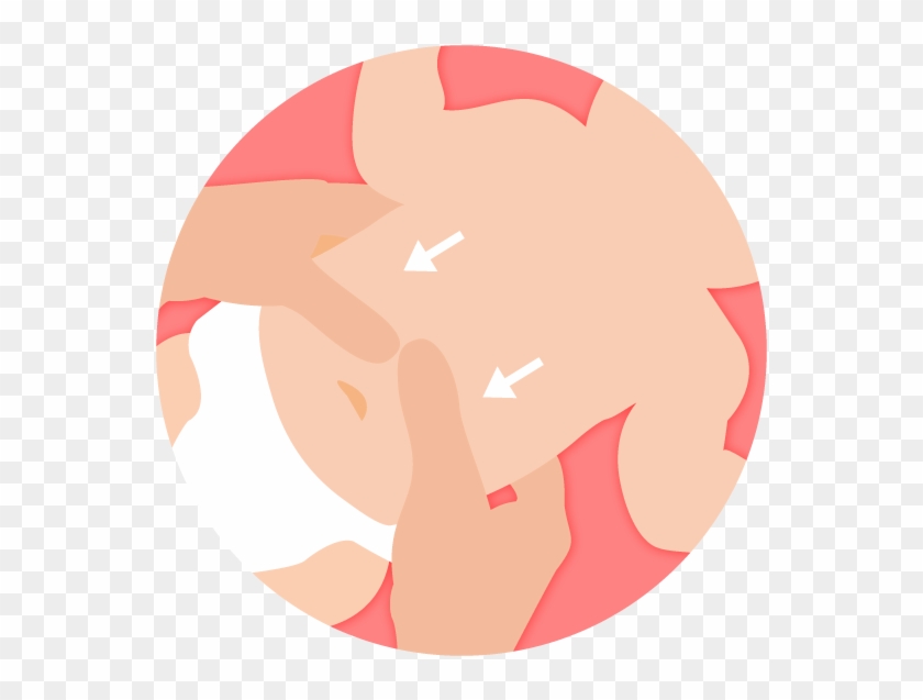 Massage Belly Gently Downward Towards Rectum - Circle #1030883