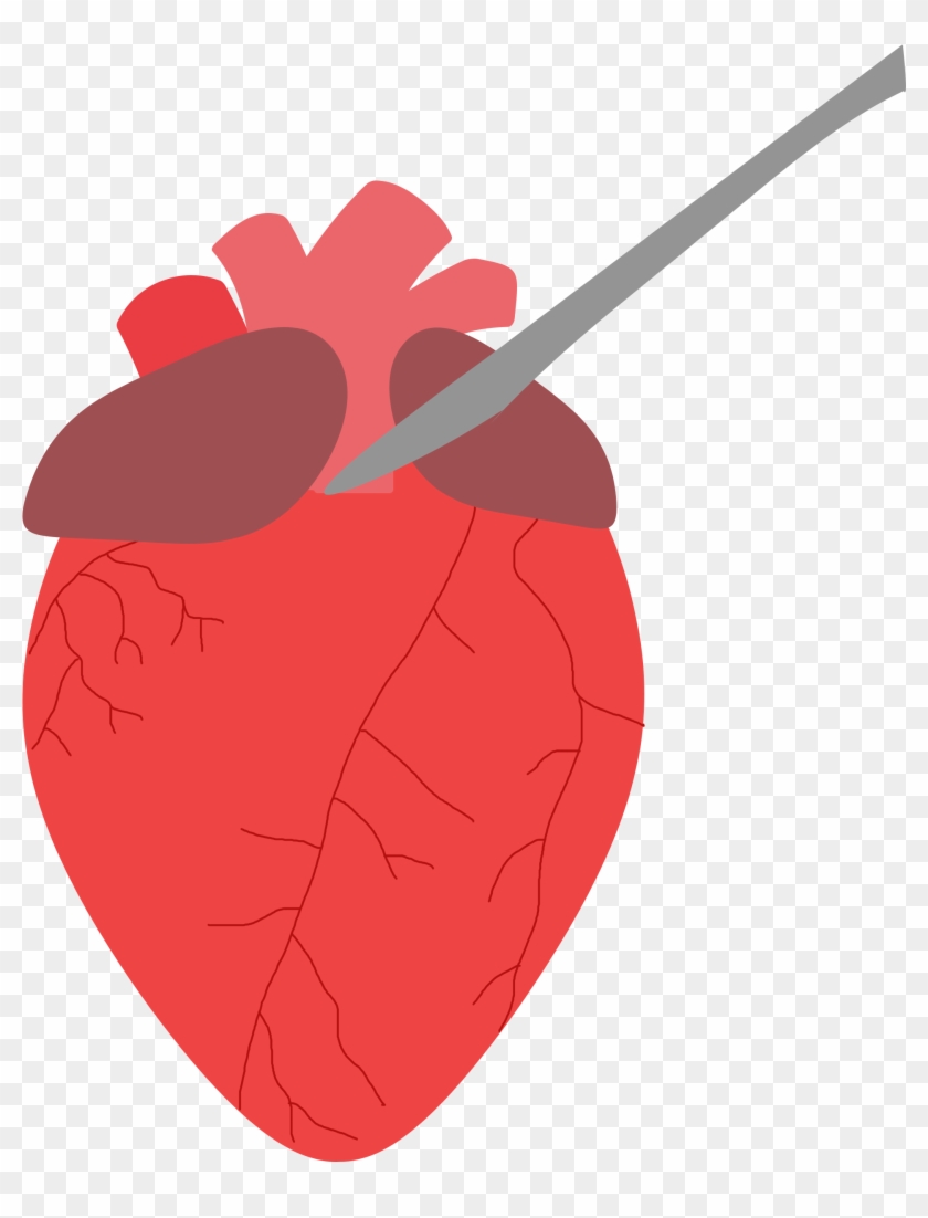 Place The Heart So The Anterior Side Is Facing Up - Gif #1038604