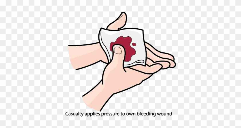 Apply First Aid Online Rh Nsfsakai Nthsydney Tafensw - Apply Pressure To Wound #1046548