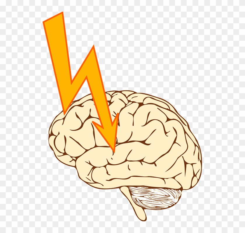 Clip Art Brain 23, Buy Clip Art - Stroke Clipart #1047868