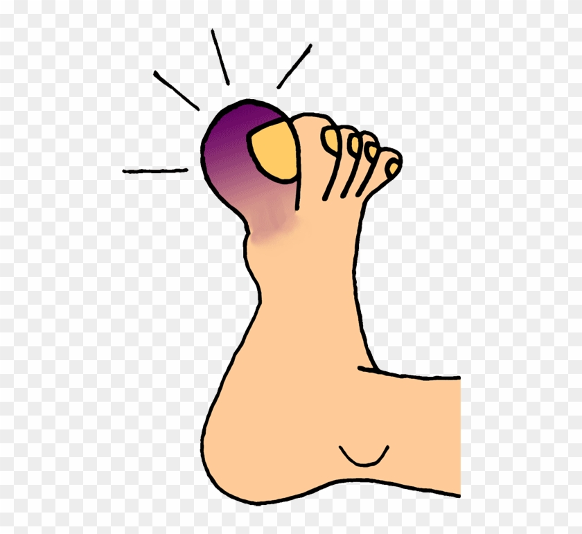 Broken Foot Cartoon - Toe Clip Art #1048400