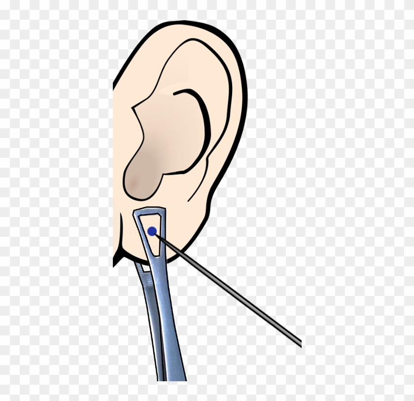 Piercing Ear Clipart - Ear Piercing Clip Art #182476