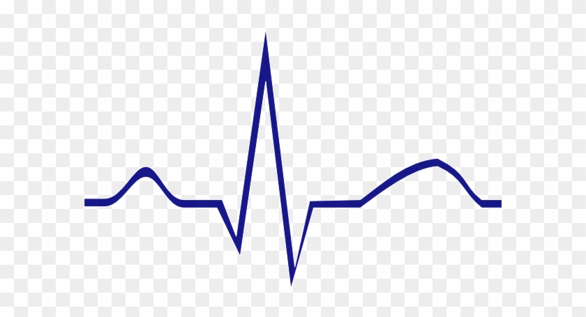 Normal Sinus Rhythm Clipart #184519