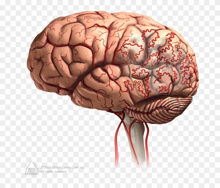 В мозге есть сосуды. Снижение кровотока в головном мозге.