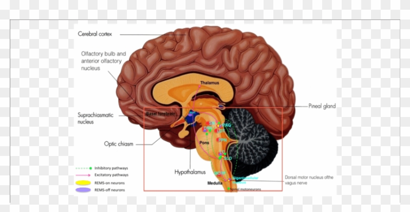 Key Brain Structures Affected By Lewy Bodies, Lewy - Raphe Nucleus Pineal Body And Scn #1078906