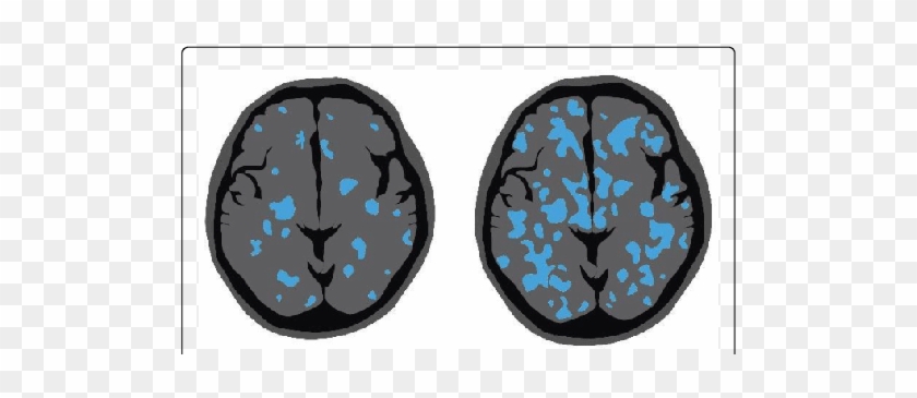 Modified From Suzuki [13] - Microglia #1079129