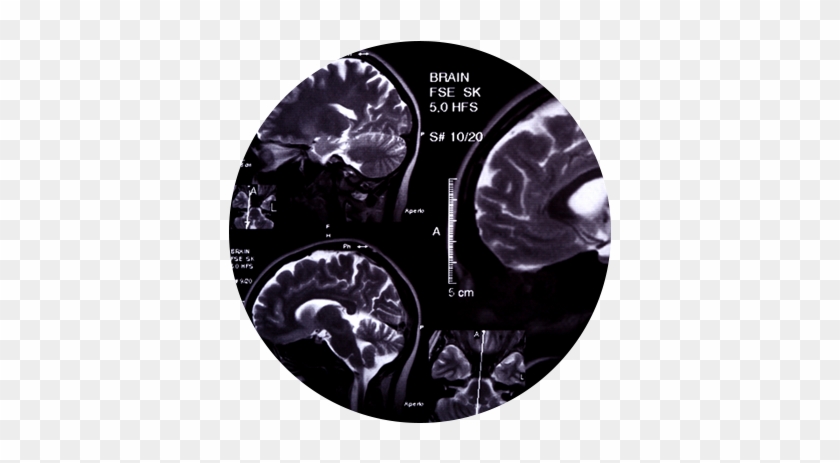Diagnosis And Treatmentlearn More - Traumatic Brain Injury #1079238