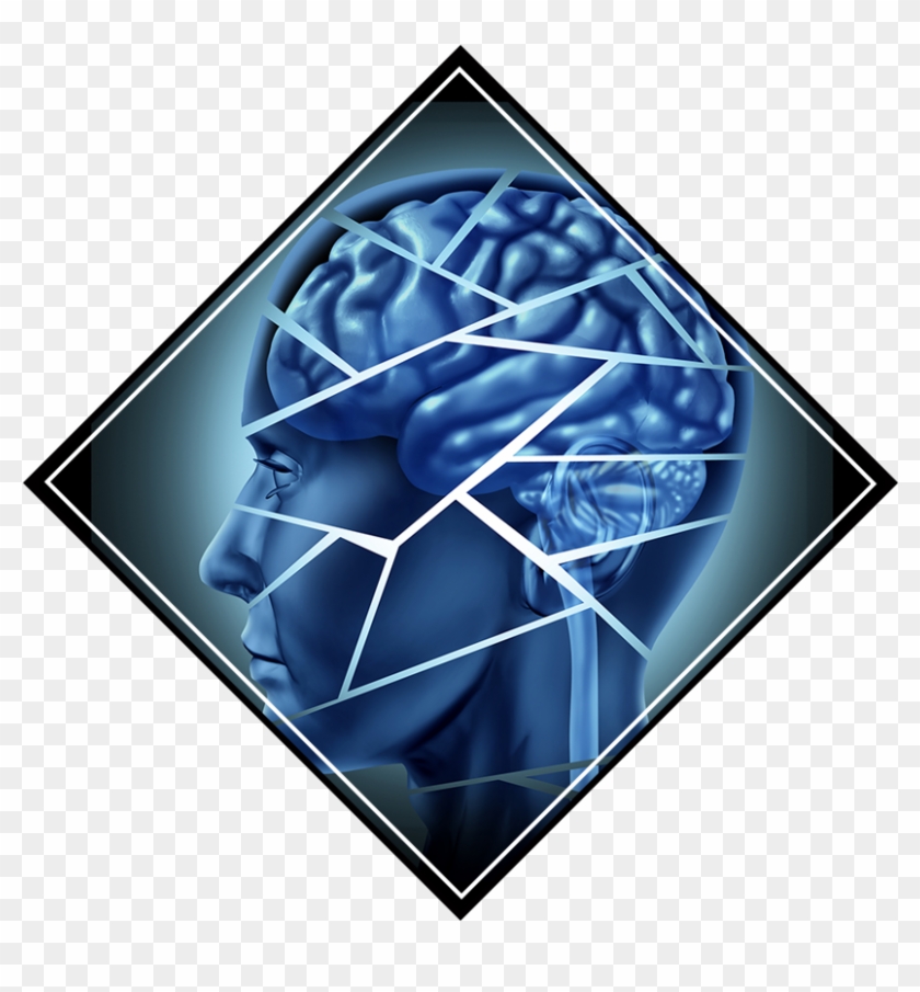 Traumatic Brain Injury Lawyer - Nlp: Maximize Your Potential- Hypnosis, Mind Control, #1079333