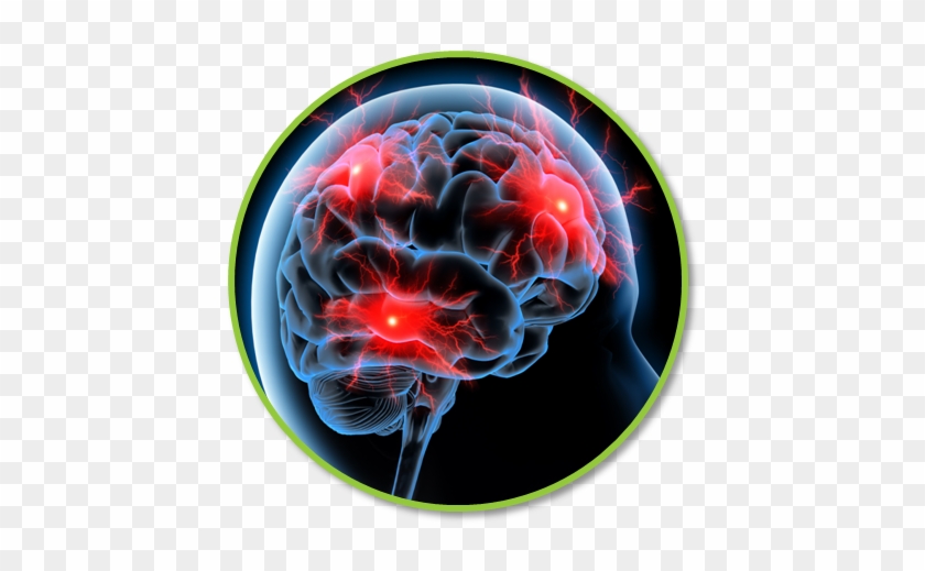 Brain Disorders - Padaczka #1079334