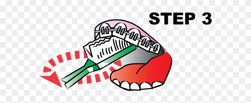 Make Sure You Slowly Brush Every Tooth And The Arches - Tooth Brushing #1080767