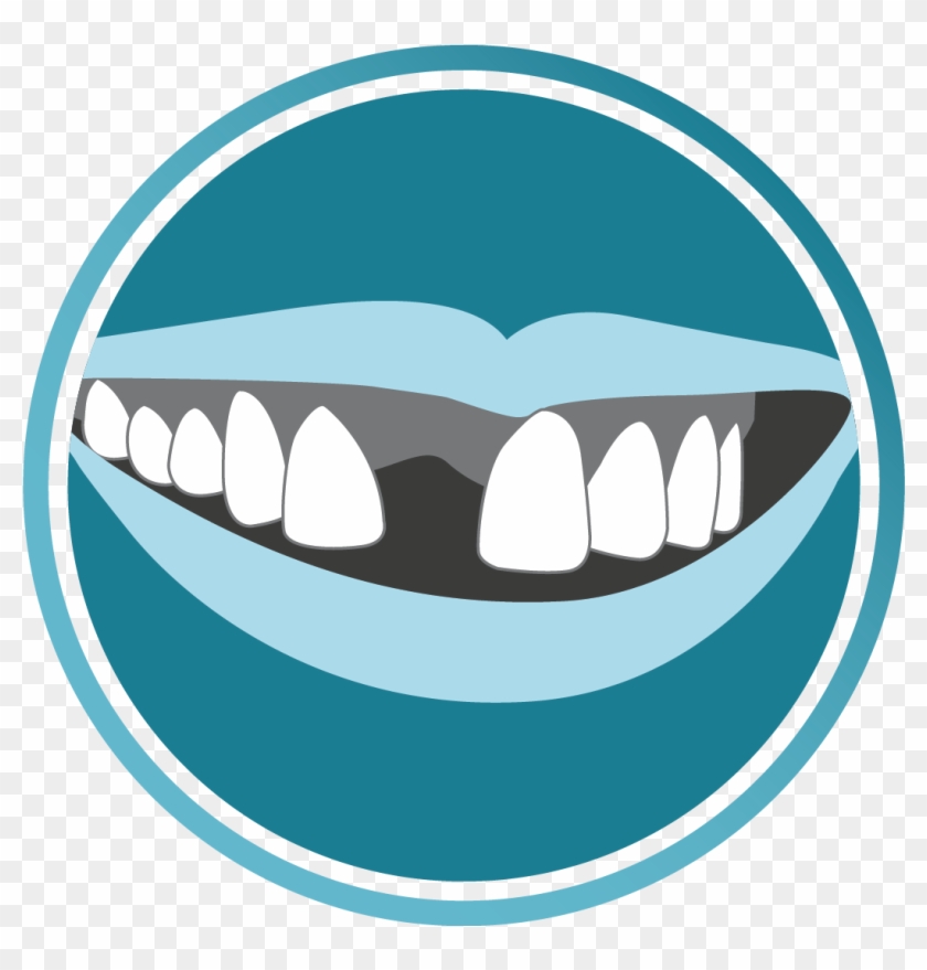 Icon Dental Implants - Dental Implant #1086972