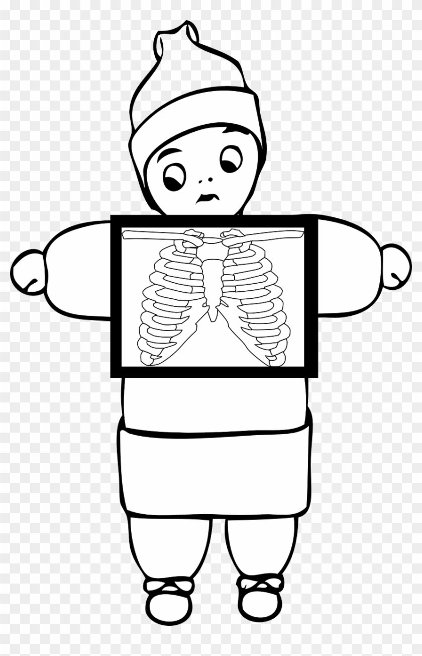 My Last Anatomy Session - Outline Picture Of X Ray #1107185