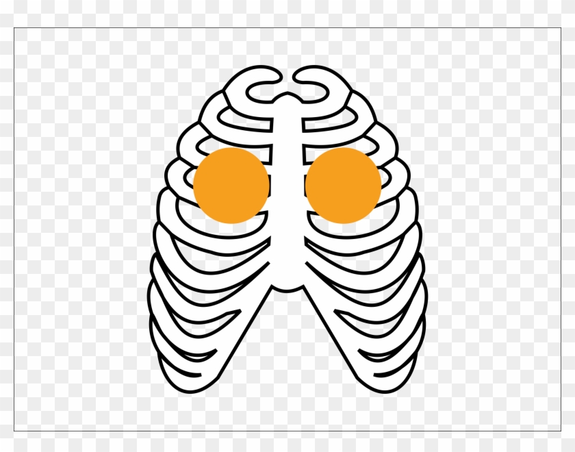 Copd - Copd #1114222