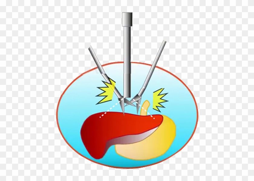 ［conventional 2k］conventional Devices Require Closer - ［conventional 2k］conventional Devices Require Closer #1128702