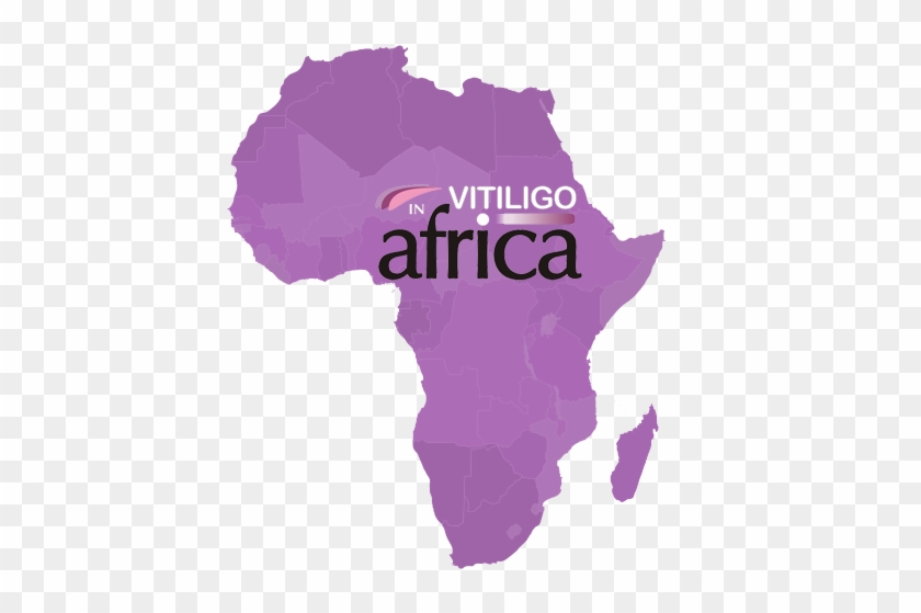 Vitiligo In Africa - Learn The Countries Of Africa #1155500