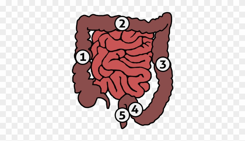 Human Colon - Types Of Bowel Diversions #1198148