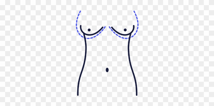 Breast Augmentation - Breast Augmentation #1198175