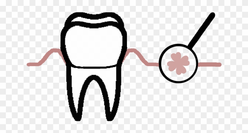 Every Year, More Cases Of Malignant Oral Tumors Are - Every Year, More Cases Of Malignant Oral Tumors Are #1251378