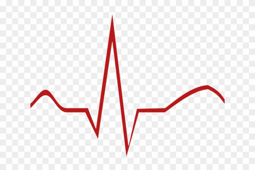 Ekg Cliparts - Diagram #1252760