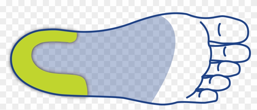 No Extrinsic Rear Foot Stabilizer - No Extrinsic Rear Foot Stabilizer #1255783