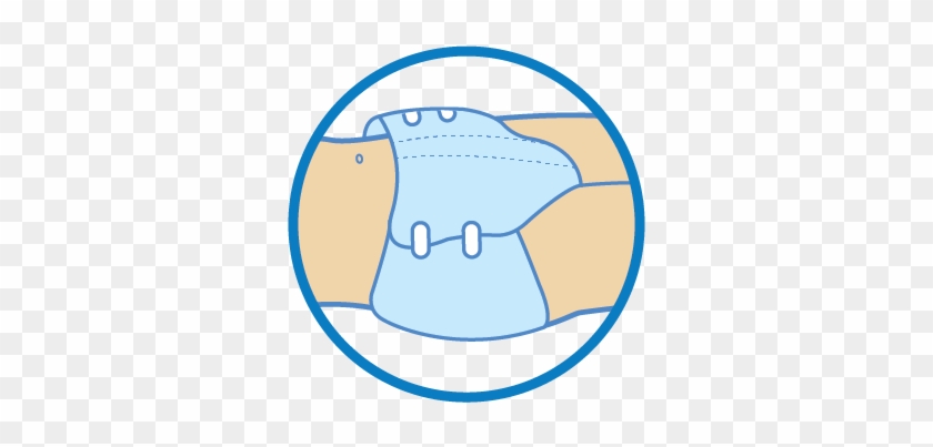 To Ensure That The Diaper Fits Correctly, Fixate The - To Ensure That The Diaper Fits Correctly, Fixate The #1280364
