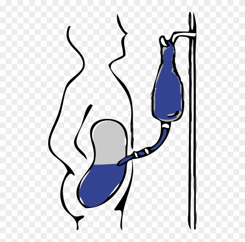 File - Dp Infusion - Svg - Happens When Your Kidneys Fail #1282419