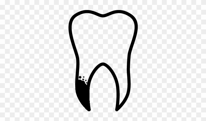 Root Canal Therapy - Root Canal Therapy #1293917