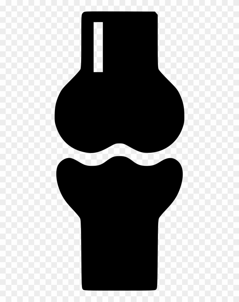 Knee Joint Joint Bone Skeleton X Ray Comments - Knee Joint Joint Bone Skeleton X Ray Comments #1306259