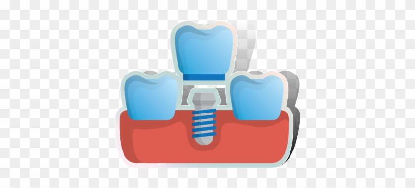 Dental Implants - Chair #1308419
