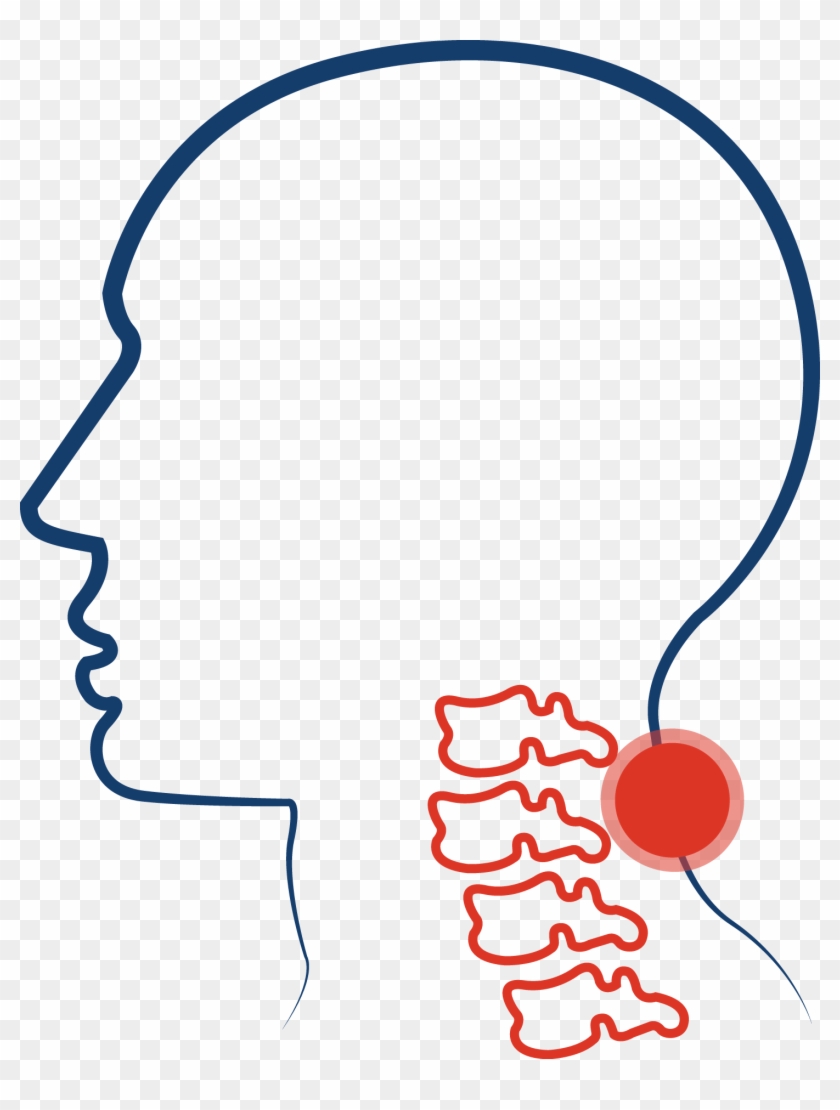 Cervical Spinal Stenosis - Cervical Spinal Stenosis #1356340