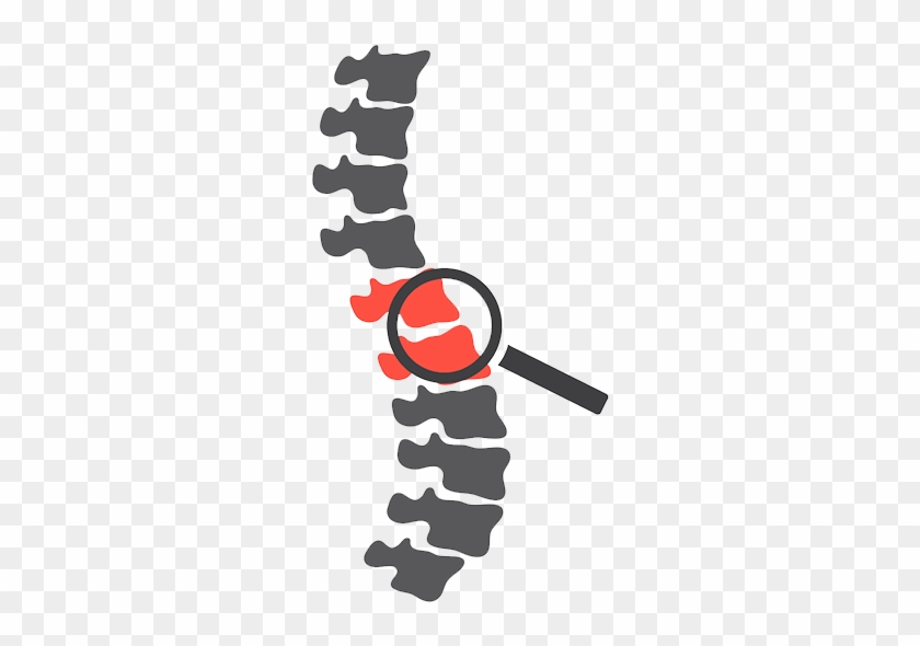 Spine - Have You Ever Heard Of A Spine Transplant #1356397