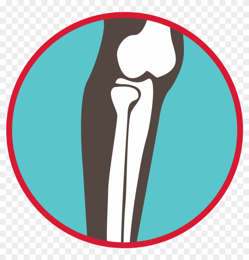 Bones Of The Leg Graphic - Howth #1366697
