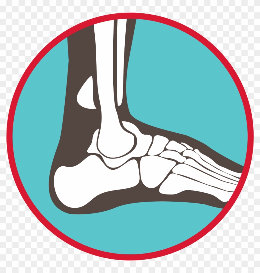 Bones Of The Ankle And Foot Graphic - Howth #1366699