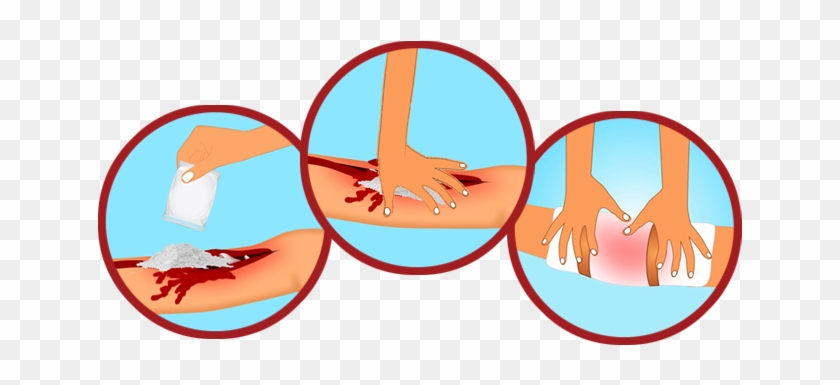 Wound Clipart Hemorrhage - Stop The Bleeding Png #1366729