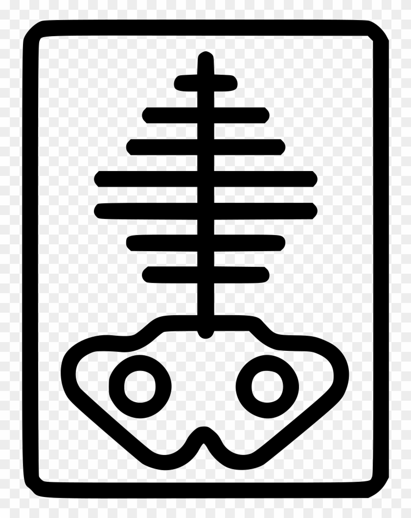 X Ray Comments - Medicine #1381820