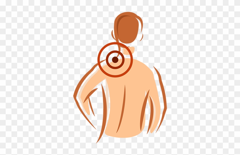 Neck & Shoulder Pain - Neck Pain Clipart Png #216784