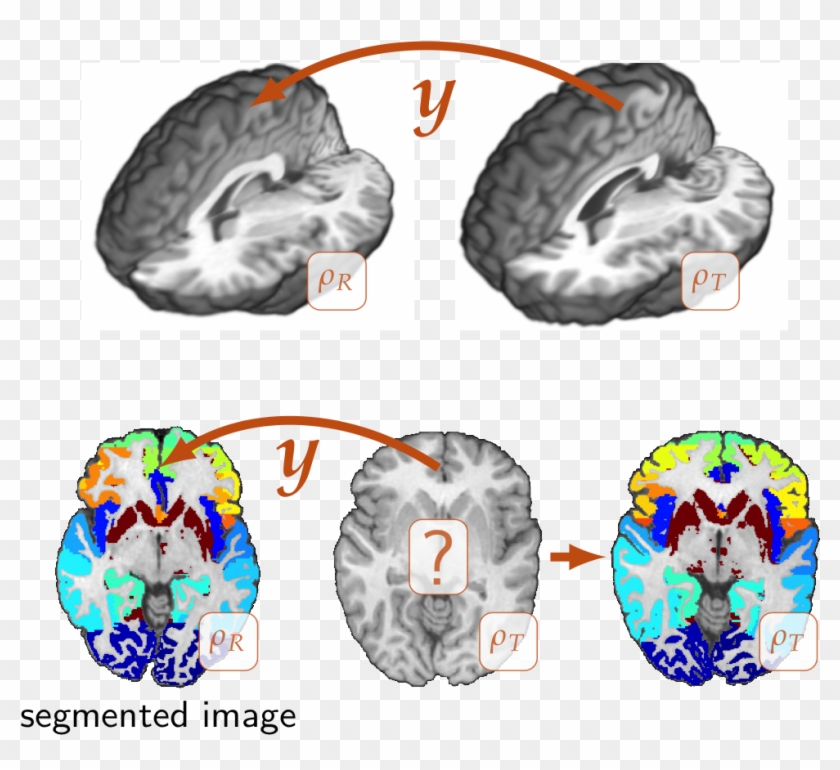 Parallel Image Registration - Parallel Image Registration #1389980