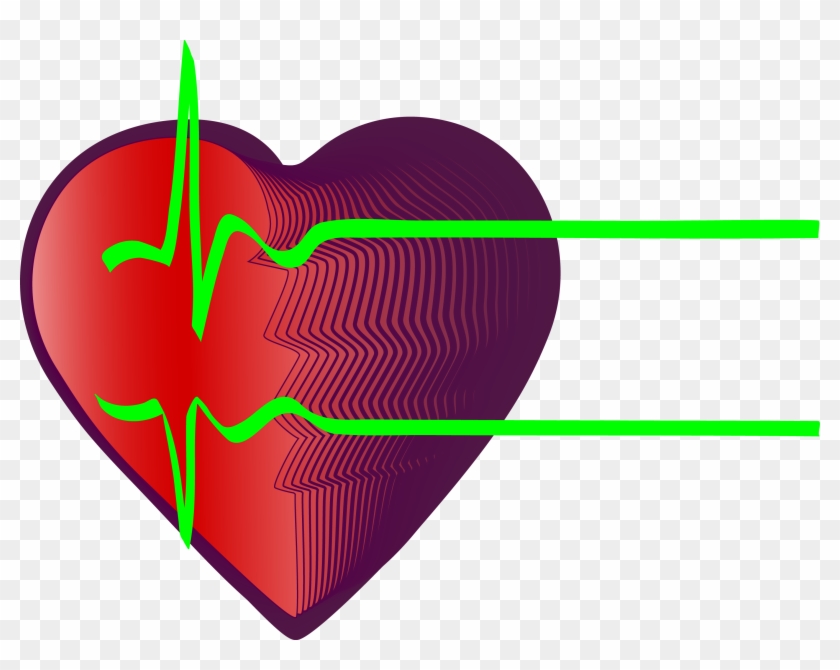 Electrocardiography Heart Rate Myocardial Infarction - Heartbeat #1393638