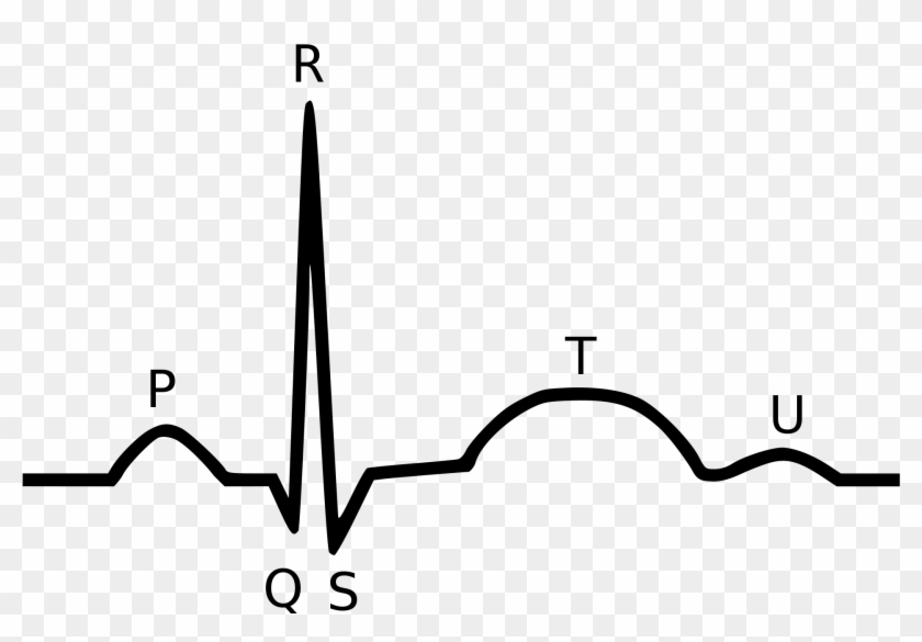 Px Qrs Fasterskier - Qrs Complex #1393643