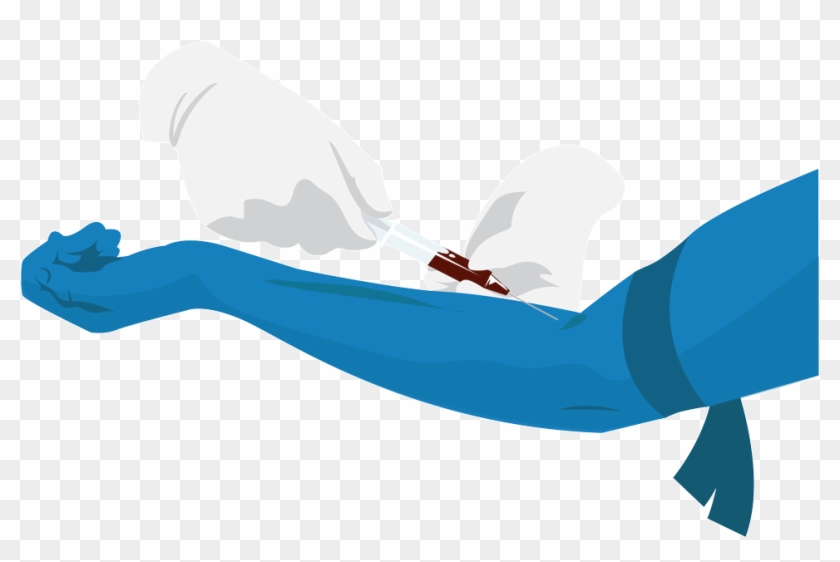 Patient Blood Samples Were Taken With 24 Hours Of Stroke - Patient Blood Samples Were Taken With 24 Hours Of Stroke #1395572