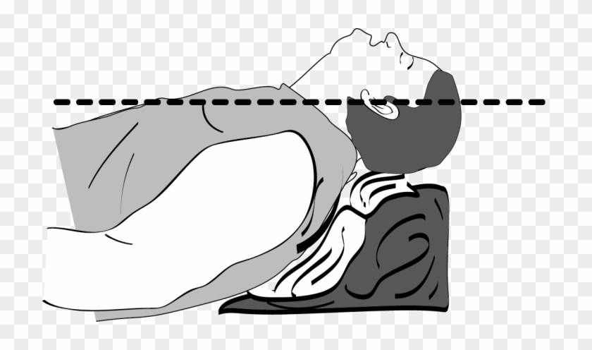 Head Up Intubation - Airway Positioning #1434972