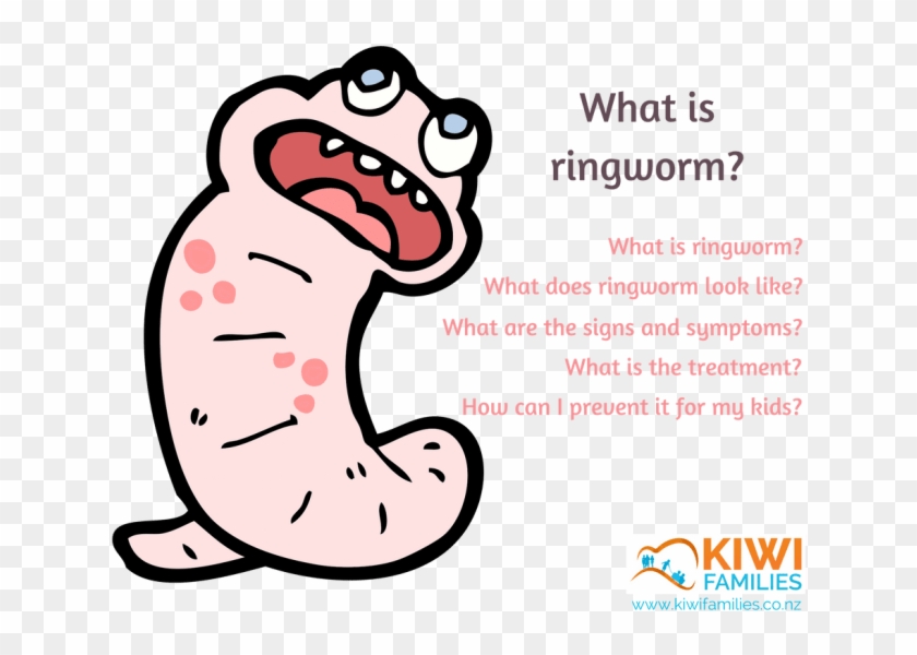 How To Treat In - Ringworm One Year Old #1442104
