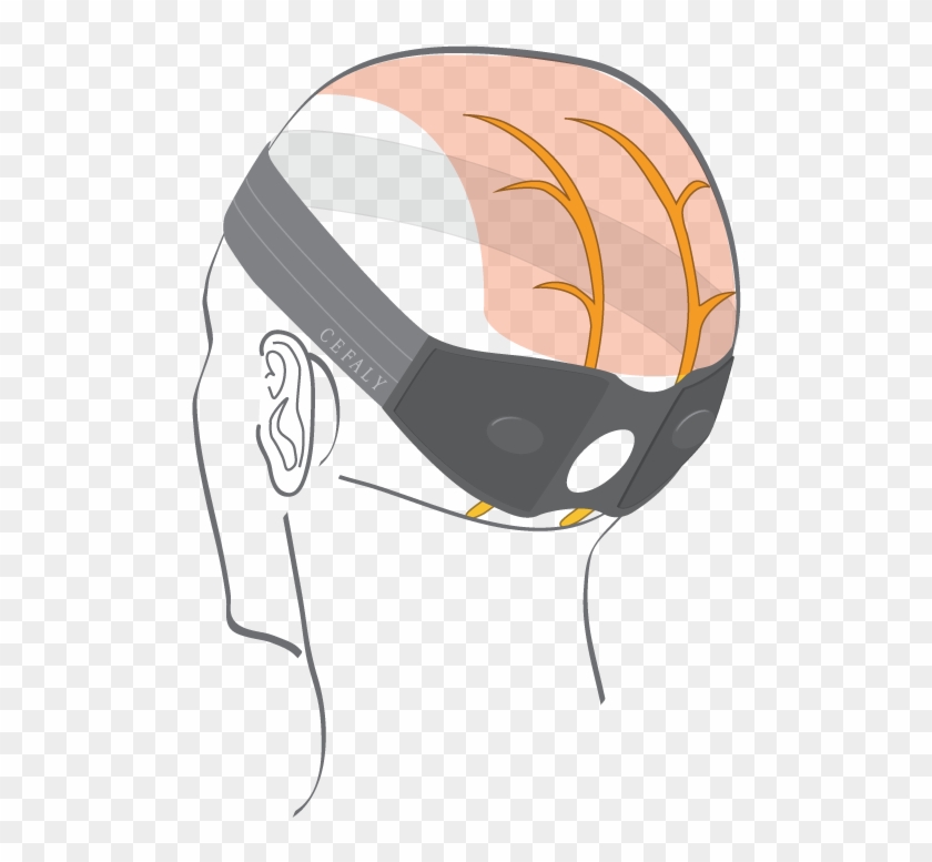 Cefaly Kit Arnold - Cefaly Arnold Kit #1445643