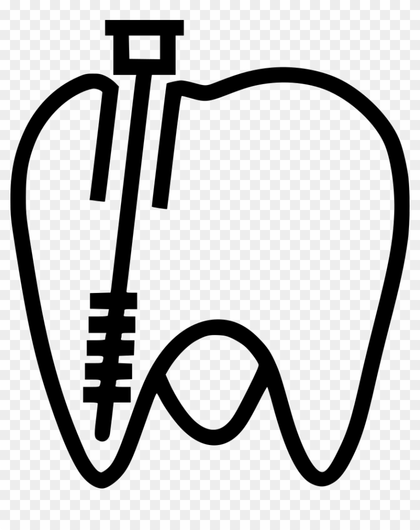 Nerve Channel Treatment Comments - Endodontia Icon #1445644