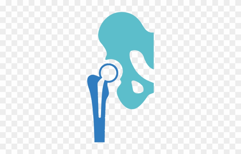 Orthopedic Surgery - Hip Implant Icon #1446552